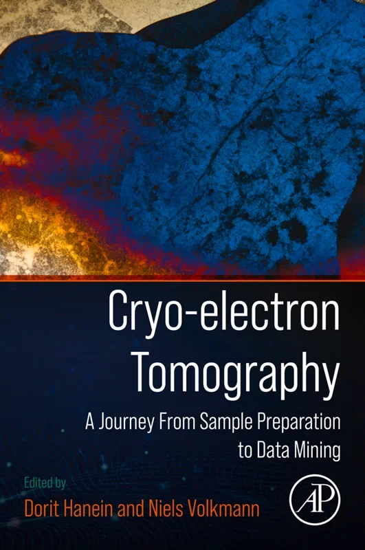Cryo-electron Tomography: A Journey from Sample Preparation to Data Mining