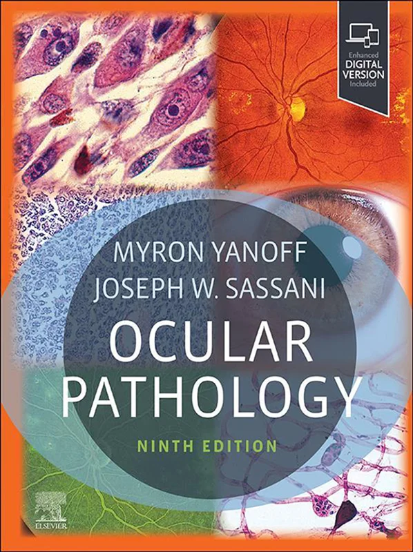 Ocular Pathology 9th Edition