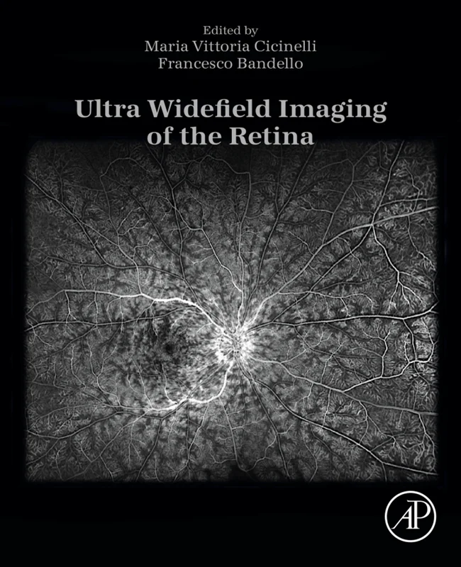 Ultra Widefield Imaging of the Retina